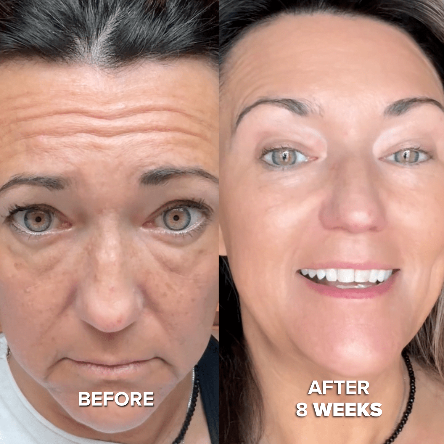 Collagen Mask - Seranova