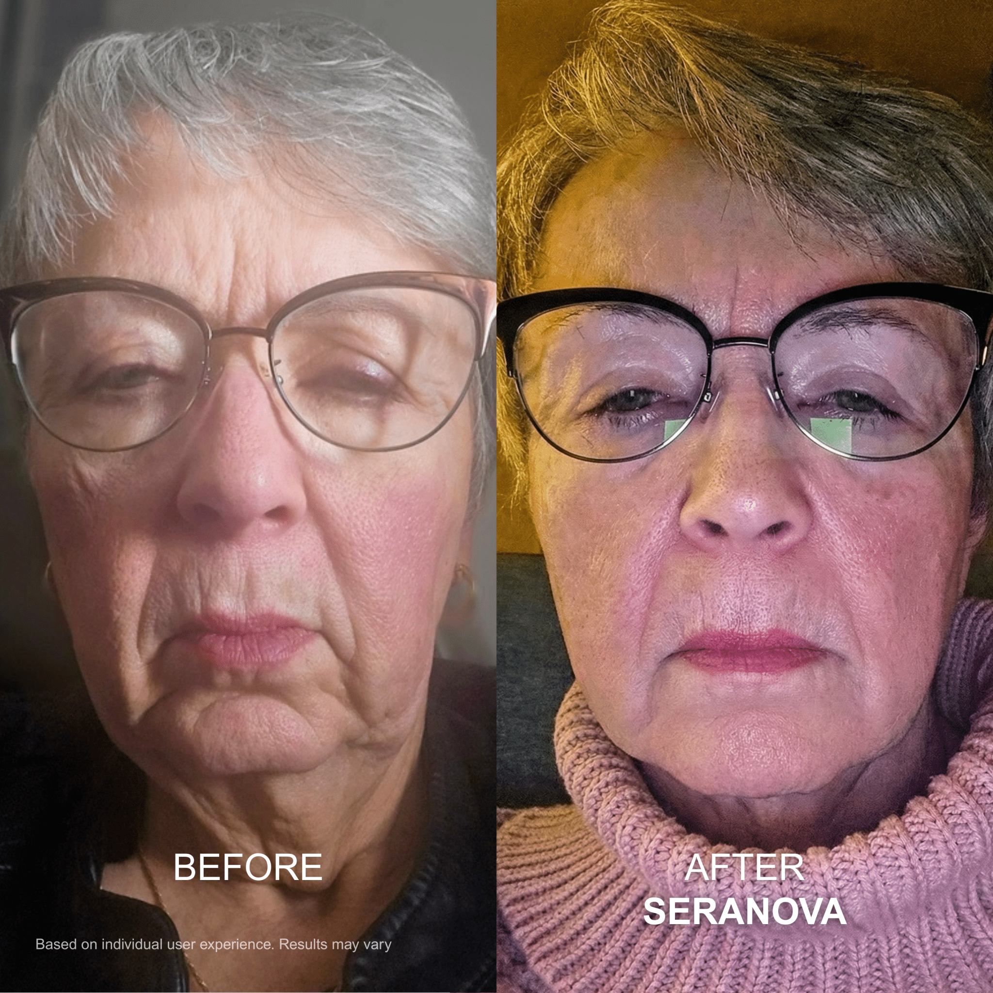 The Micro Infusion System™ - Seranova