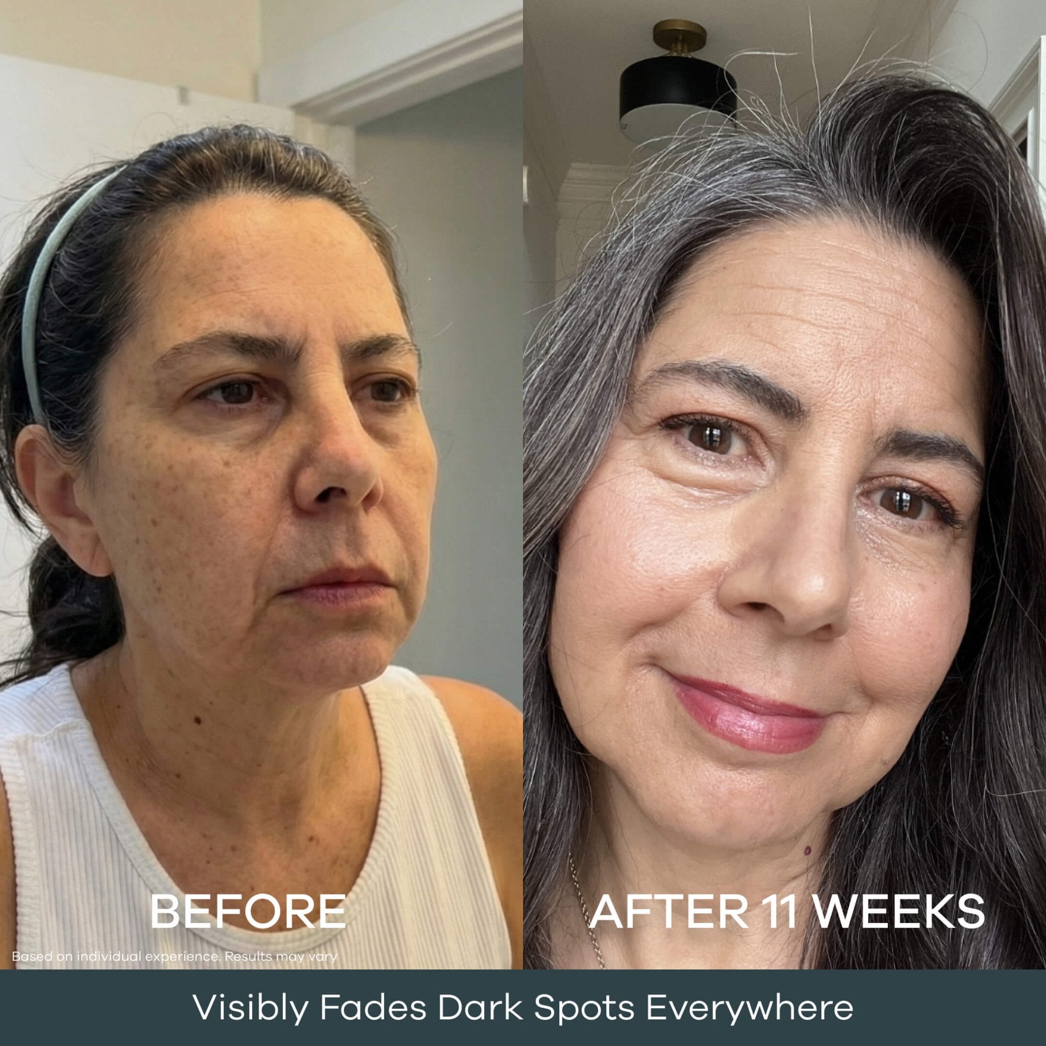 The Micro Infusion System Dark Spot System™ - Seranova