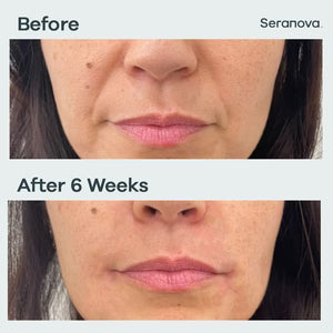 Seranova 