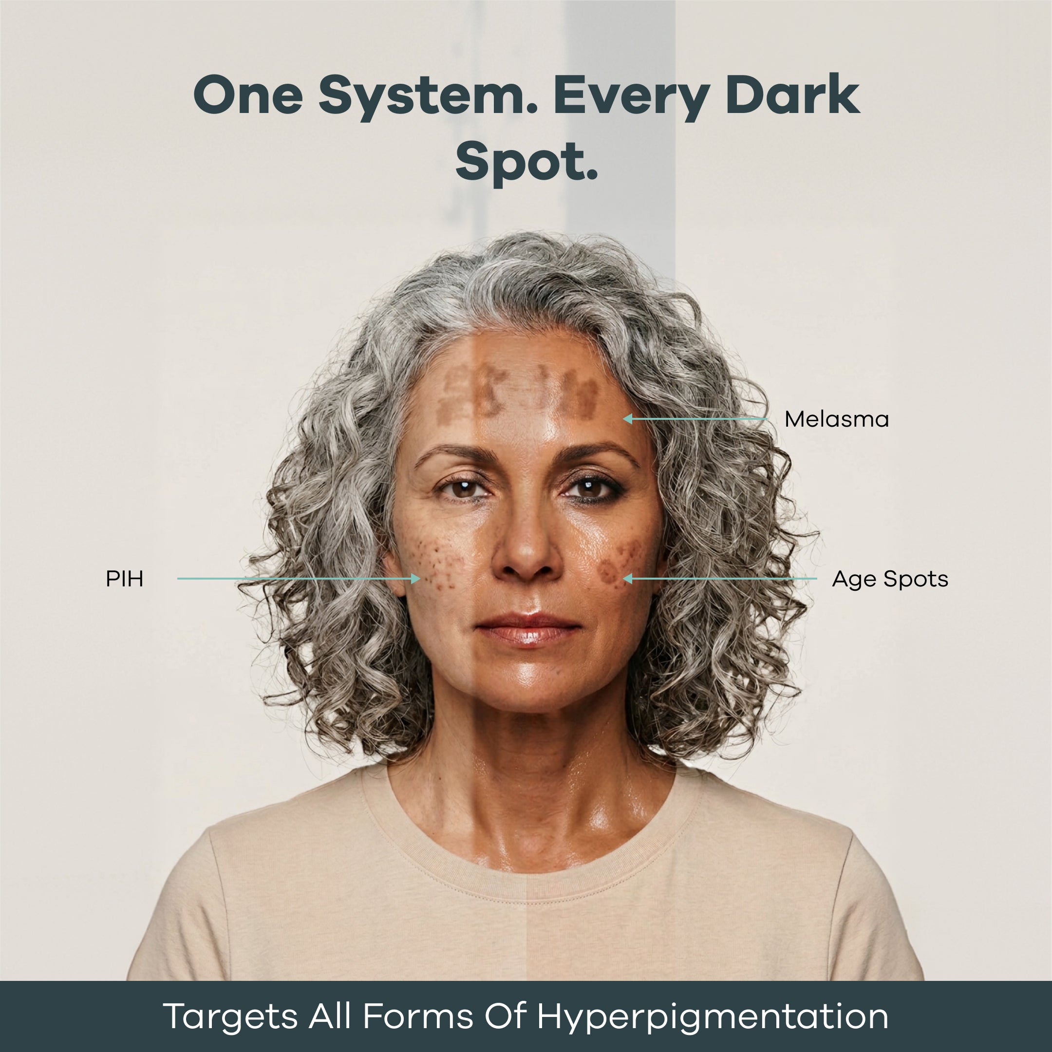 The Micro Infusion Pigmentation System™