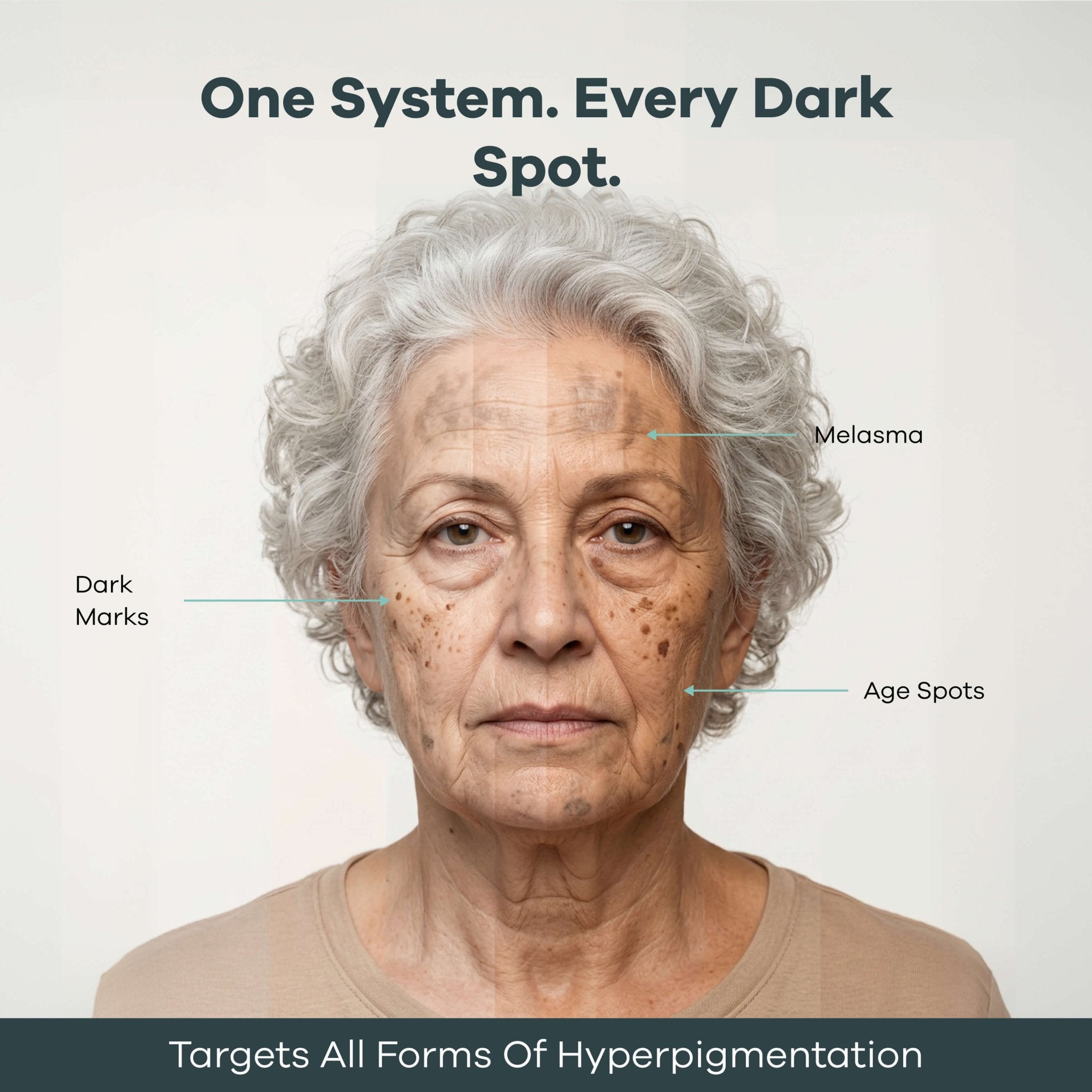 The Micro Infusion Pigmentation System™ - Seranova