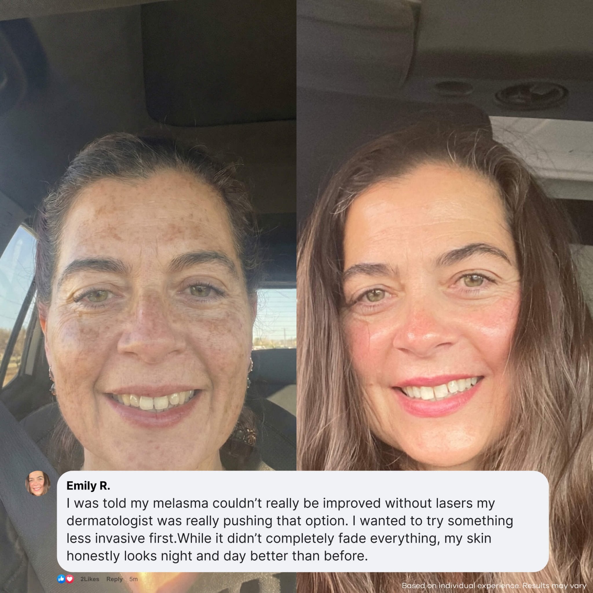 The Micro Infusion System Dark Spot System™ - Seranova